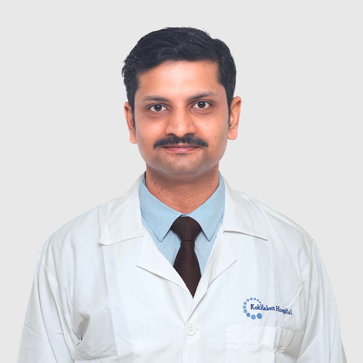 Dr. Kunal Nadgouda - Neuro radiologist in Mumbai