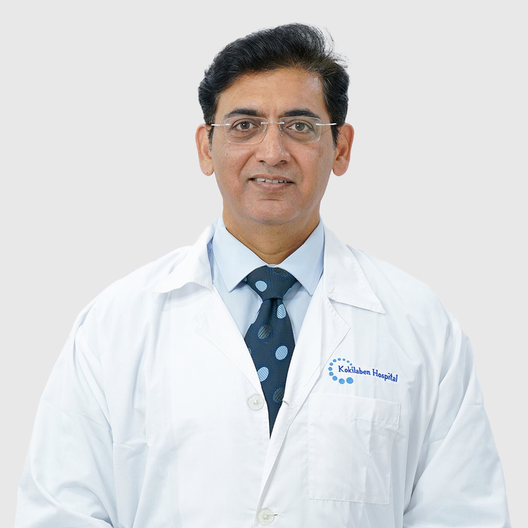  Dr. Ravi Nagar - Best Urologist Specialist in Indore, Specializes in Urology and Kidney Transplant Surgery 