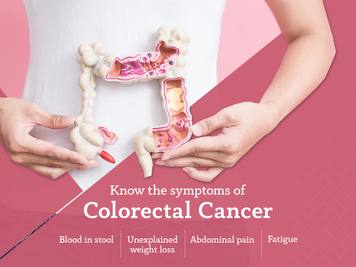 Symptoms of Colorectal cancer