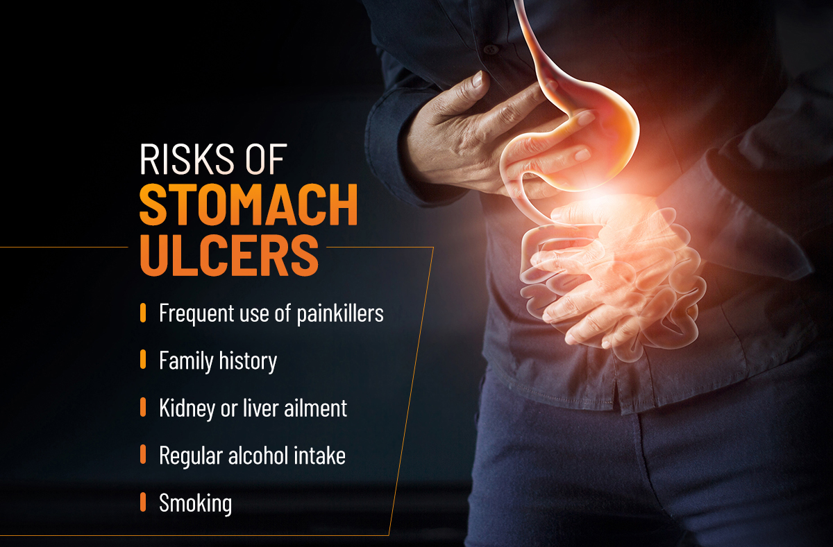 Risks of stomach ulcers