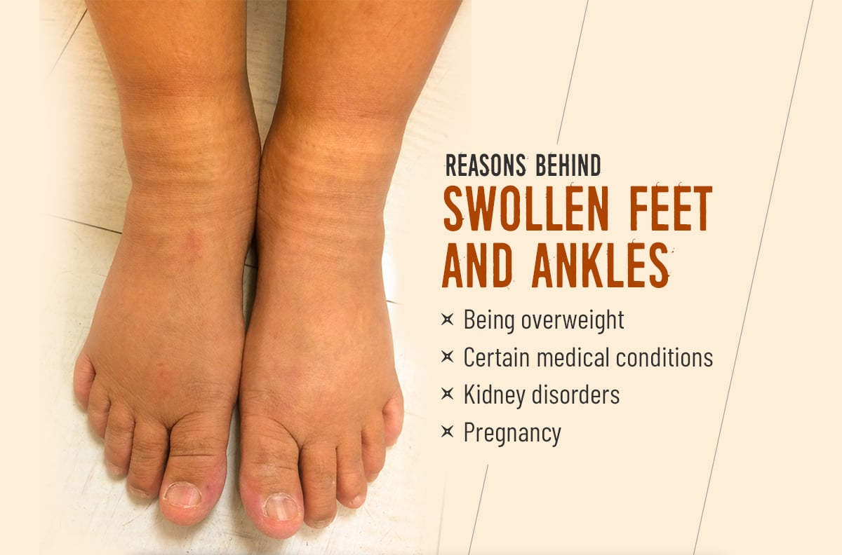 What are the reasons behind swollen feet and ankles?