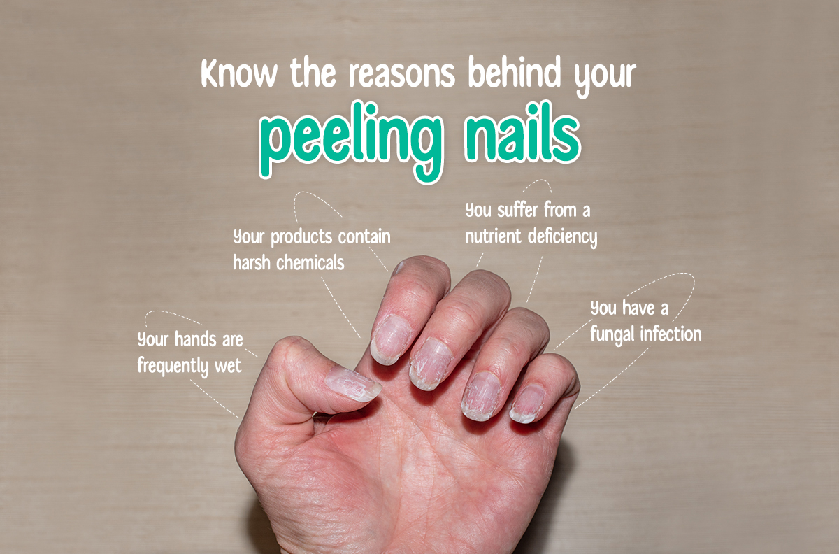 Know The Reasons Behind Your Peeling Nails