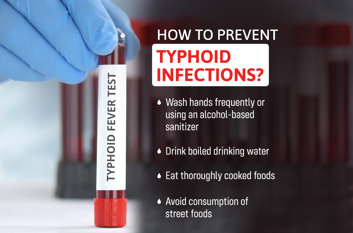 How To Prevent Typhoid Infections 