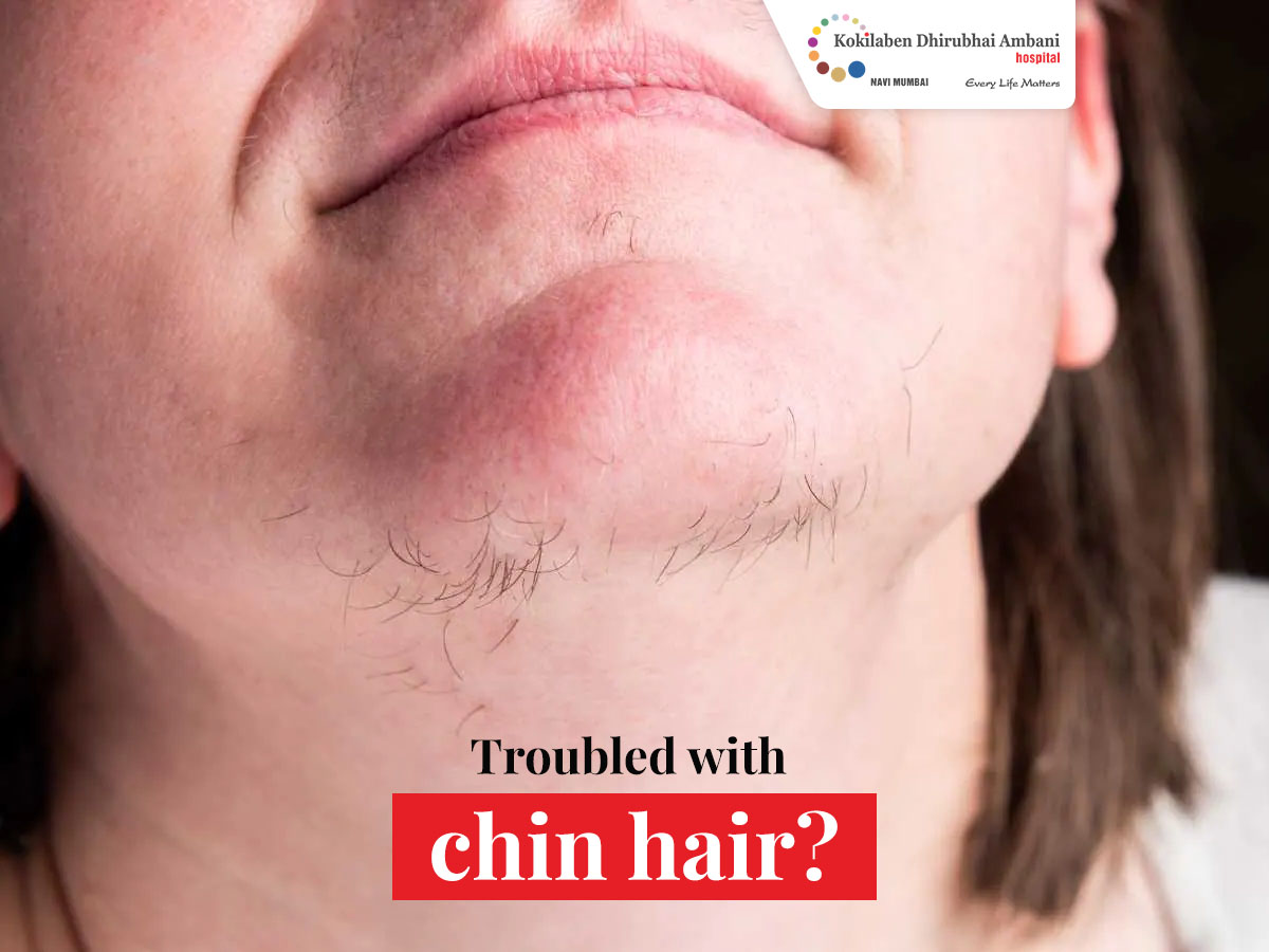Female Chin Hair Causes Sale Codes | mpscmaterial.com