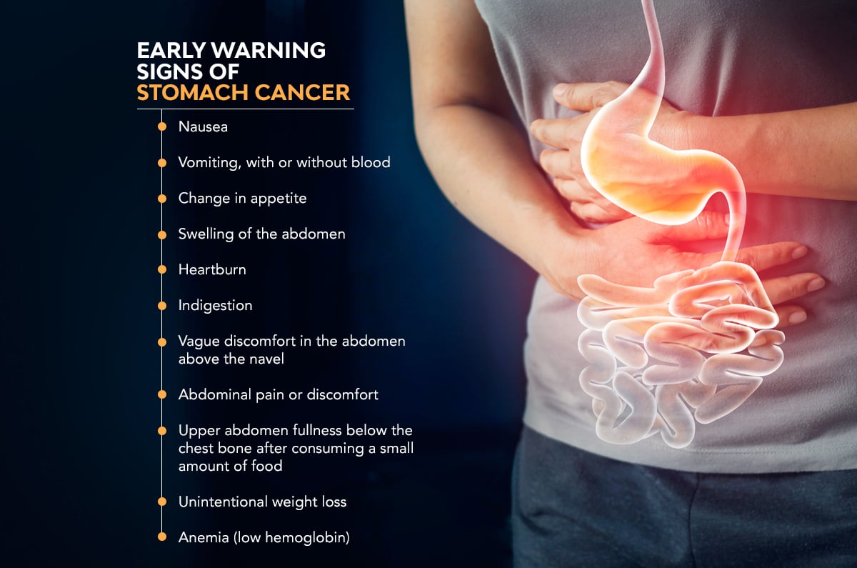 stomach cancer signs and symptoms early        <h3 class=