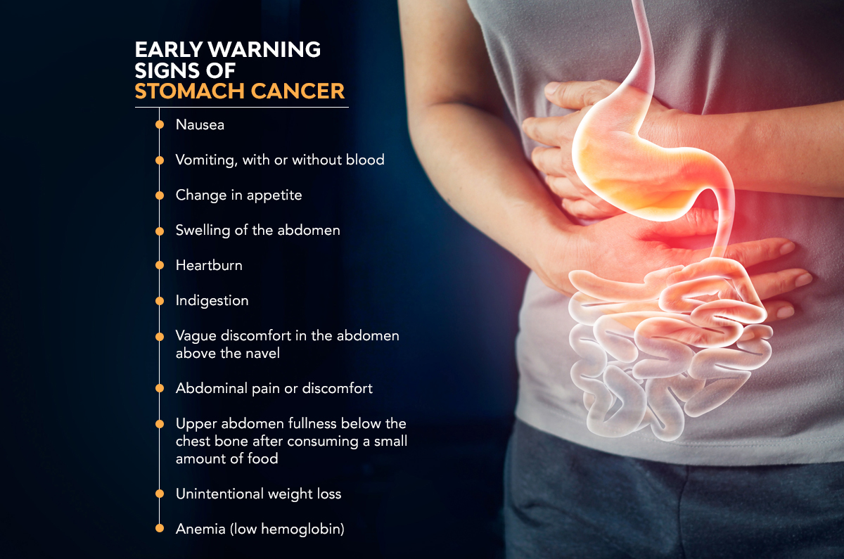 Early Warning Signs Of Stomach Cancer