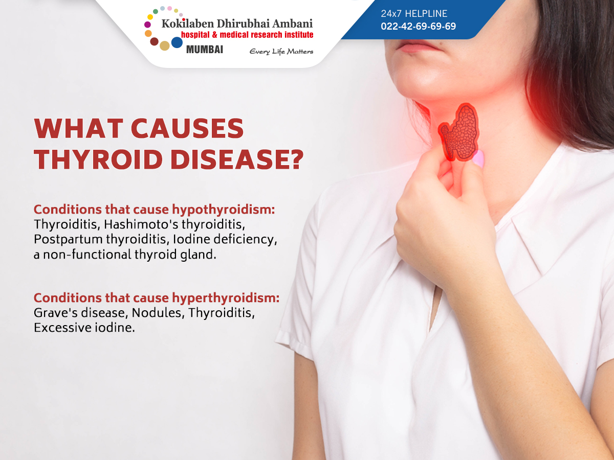 What Causes Thyroid Disease 