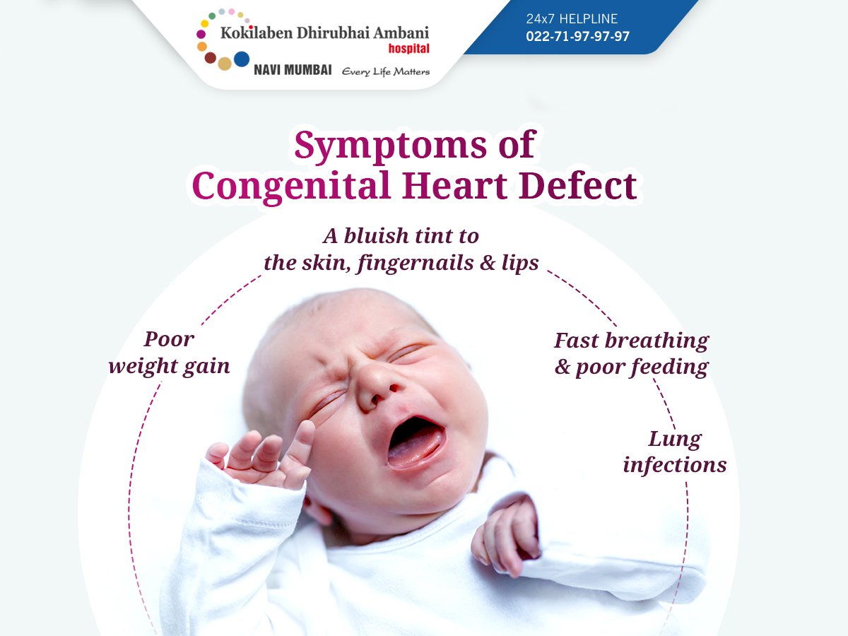 congenital heart defects symptoms