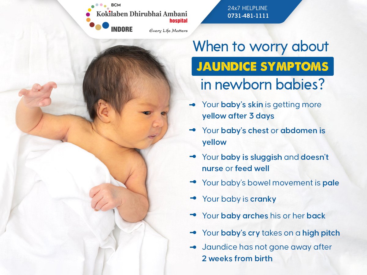 When to worry about jaundice symptoms in newborn babies?