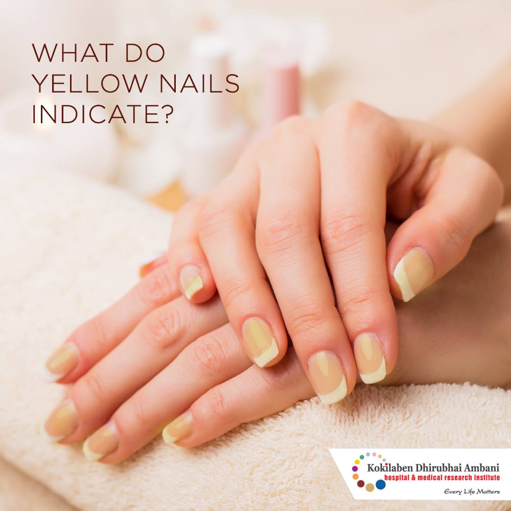 Nails Say Very Important Things About Your Health